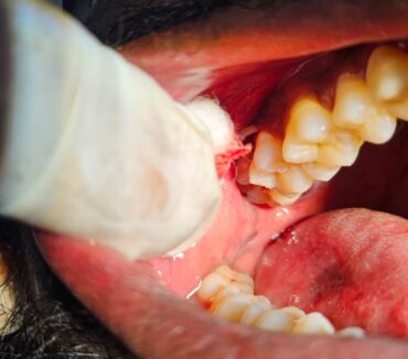 Best Dental Clinic in Chandanagar (Subha Sree Multi Speciality Dental Hospital)