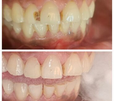 Best Dental Clinic in Chandanagar (Subha Sree Multi Speciality Dental Hospital)